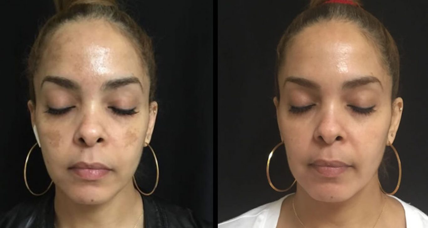 skin Lightening creams in Pretoria