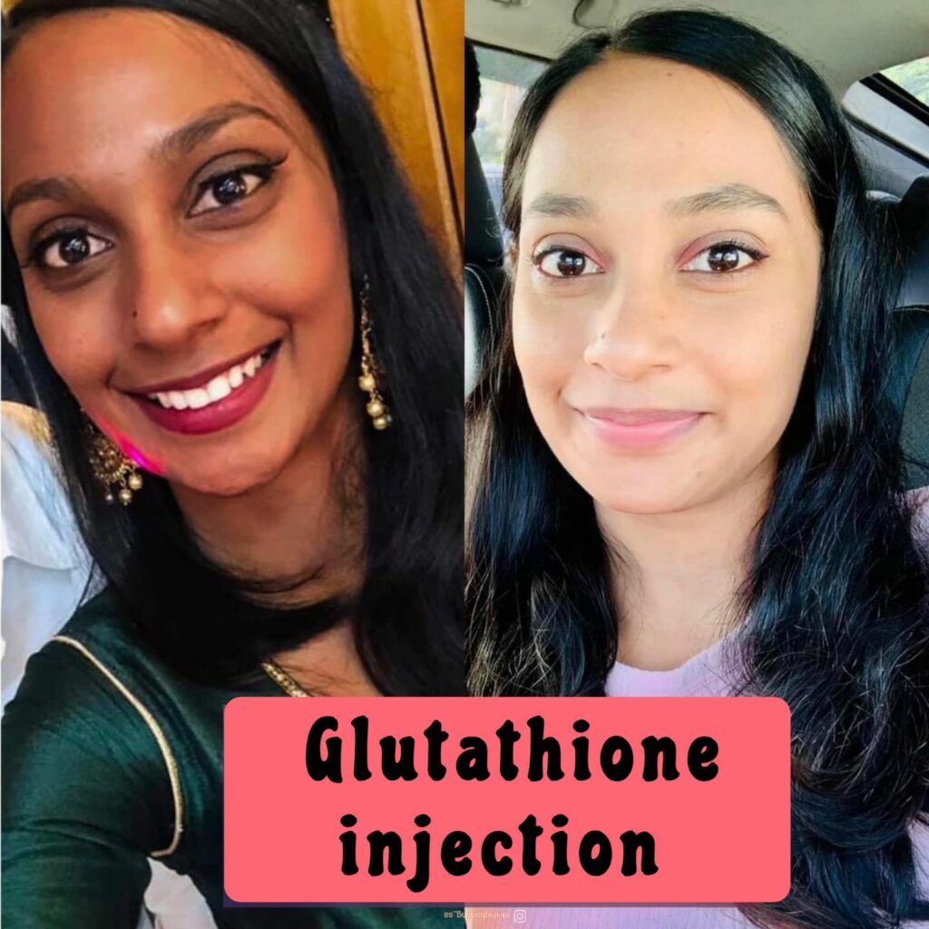 glutathione injection in Spruitview