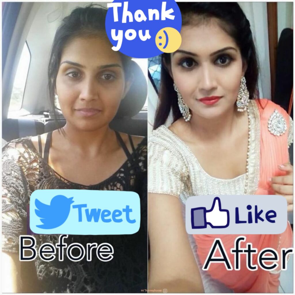 Whitening injection in Pretoria
